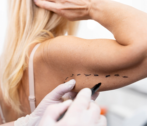 Lifting braquial (braços)