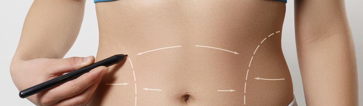 Mommy makeover: saiba tudo sobre a cirurgia pós-gravidez