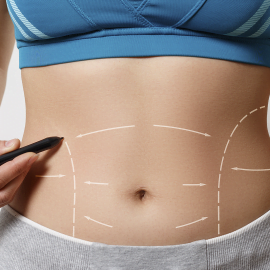 Mommy makeover: saiba tudo sobre a cirurgia pós-gravidez