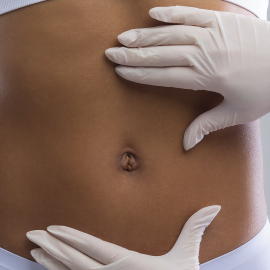 Lipoaspiração no abdômen: saiba 11 cuidados necessários