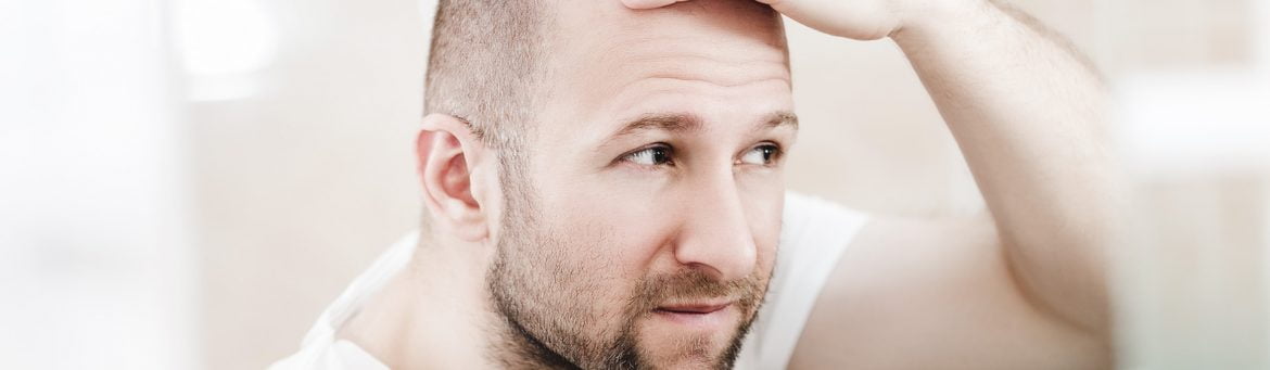 Transplante capilar: saiba tudo sobre o procedimento