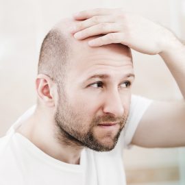 Transplante capilar: saiba tudo sobre o procedimento